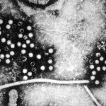 裙带菜03-显微镜下的戊型肝炎病毒