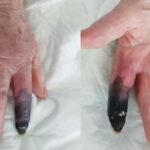 黑手指
